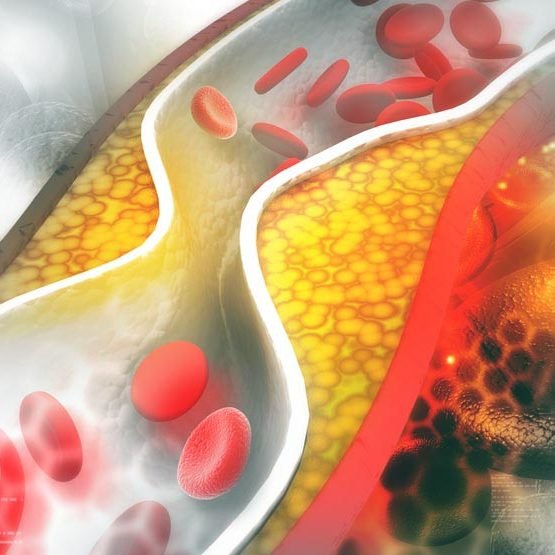 nutrizionista per dislipidemia roma